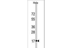 Western blot analysis of IFITM3 polyclonal antibody  in HeLa cell line lysates (35 ug/lane).