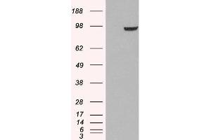 HEK293 overexpressing PDE5A and probed with ABIN2564436 (mock transfection in first lane). (PDE5A antibody  (C-Term))