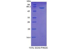 SDS-PAGE (SDS) image for Thrombospondin 4 (THBS4) (AA 644-925) protein (His tag,GST tag) (ABIN2123657)