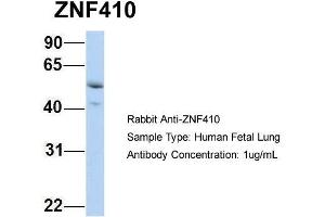 Host: Rabbit Target Name: ZNF410 Sample Type: Human Fetal Lung Antibody Dilution: 1. (ZNF410 antibody  (N-Term))