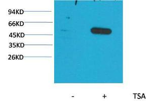 Western Blot (WB) analysis of extracts from HeLa cells, untreated (-) or treated with TSA (1muM, 18 hr+), using Acetyl- a-tubulin(Lys40) Mouse Monoclonal Antibody 1:2000. (alpha Tubulin antibody  (acLys40))