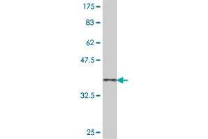 Western Blot detection against Immunogen (38. (WASP antibody  (AA 57-170))