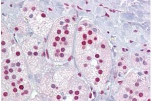 Anti-ROR Alpha antibody IHC staining of human adrenal. (RORA antibody  (AA 36-85))