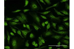 Immunofluorescence of monoclonal antibody to EIF4EBP3 on HeLa cell. (EIF4EBP3 antibody  (AA 1-100))