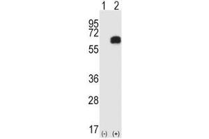 Western blot analysis of RIPK2 antibody and 293 cell lysate either nontransfected (Lane 1) or transiently transfected (2) with the RIPK2 gene. (RIPK2 antibody  (AA 458-488))