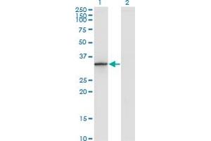 Western Blot analysis of DHRS9 expression in transfected 293T cell line by DHRS9 monoclonal antibody (M06), clone 3E3. (DHRS9 antibody  (AA 1-319))