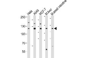 Western blot analysis of lysates from Hela, A549, MCF-7 cell line, mouse liver, mouse small intestine tissue lysate(from left to right), using ZN Antibody (Center) (ABIN6242706 and ABIN6577885). (ZNF281 antibody  (AA 416-450))