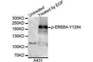 Western blot analysis of extracts of A431 cell line, using Phospho-ERBB4-Y1284 antibody. (ERBB4 antibody  (pTyr1284))