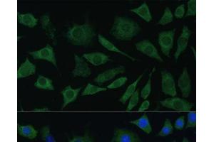 Immunofluorescence analysis of L929 cells using BMPR1B Polyclonal Antibody at dilution of 1:100. (BMPR1B antibody)