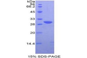 SDS-PAGE (SDS) image for Proto-Oncogene Pim-2 (Serine Threonine Kinase) (PIM2) (AA 98-319) protein (His tag) (ABIN2126304) (PIM2 Protein (AA 98-319) (His tag))