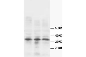 Western Blotting (WB) image for anti-Calponin 1 (CNN1) antibody (ABIN1105641) (CNN1 antibody)
