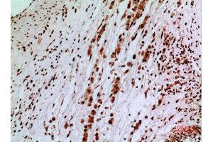 Immunohistochemistry (IHC) analysis of paraffin-embedded Human Brain, antibody was diluted at 1:100. (SAMHD1 antibody  (Internal Region))