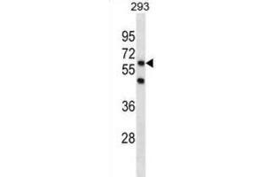 Western Blotting (WB) image for anti-PiggyBac Transposable Element Derived 3 (PGBD3) antibody (ABIN3001306)