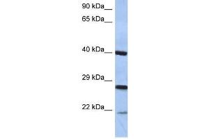Western Blot showing CIDEB antibody used at a concentration of 1-2 ug/ml to detect its target protein. (CIDEB antibody  (Middle Region))
