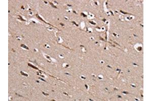 The image on the left is immunohistochemistry of paraffin-embedded Human brain tissue using ABIN7131459(TRAFD1 Antibody) at dilution 1/20, on the right is treated with fusion protein. (TRAFD1 antibody)
