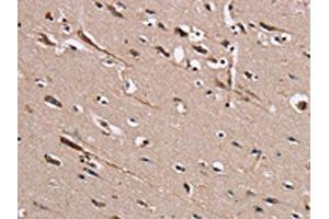 The image on the left is immunohistochemistry of paraffin-embedded Human brain tissue using ABIN7131459(TRAFD1 Antibody) at dilution 1/20, on the right is treated with fusion protein. (TRAFD1 antibody)