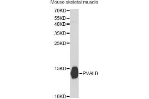 Western blot analysis of extracts of mouse skeletal muscle, using PVALB antibody.