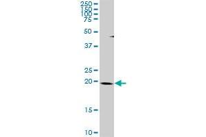 THAP1 MaxPab rabbit polyclonal antibody. (THAP1 antibody  (AA 1-213))