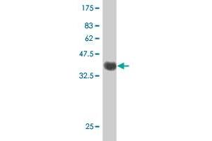 Western Blot detection against Immunogen (38. (PDXK antibody  (AA 51-160))