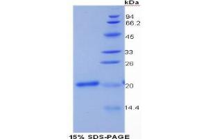 SDS-PAGE analysis of Human Collagen Type XV Protein. (COL15 Protein)
