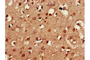 Immunohistochemistry of paraffin-embedded human brain tissue using ABIN7166795 at dilution of 1:100