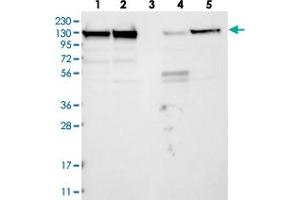 Western blot analysis of Lane 1: RT-4, Lane 2: U-251 MG, Lane 3: Human Plasma, Lane 4: Liver, Lane 5: Tonsil with MATR3 polyclonal antibody  at 1:250-1:500 dilution. (MATR3 antibody)