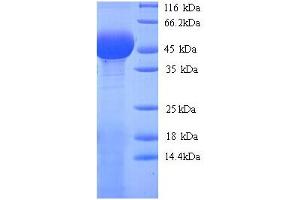 SDS-PAGE (SDS) image for PLY1 (AA 22-375) protein (His tag) (ABIN5714448) (PLY1 (AA 22-375) protein (His tag))