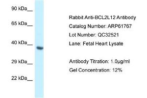 Western Blotting (WB) image for anti-BCL2-Like 12 (Proline Rich) (BCL2L12) (Middle Region) antibody (ABIN2788895) (BCL2L12 antibody  (Middle Region))