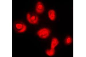Immunofluorescent analysis of DUSP16 staining in COLO205 cells. (DUSP16 antibody  (C-Term))
