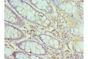 Immunohistochemistry of paraffin-embedded human colon tissue using ABIN7172503 at dilution of 1:100 (DP1 antibody  (AA 1-290))
