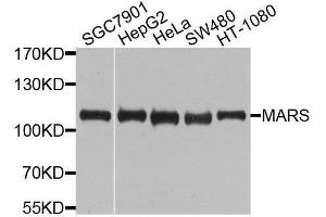 Western blot analysis of extracts of various cell lines, using MARS antibody. (Mars (MARS) (AA 1-270) antibody)