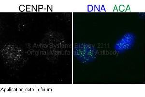 Image no. 1 for anti-Centromere Protein N (CENPN) (Middle Region) antibody (ABIN2787136) (CENPN antibody  (Middle Region))