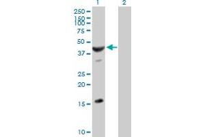 Western Blot analysis of ASB6 expression in transfected 293T cell line by ASB6 MaxPab polyclonal antibody. (ASB6 antibody  (AA 1-421))