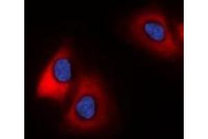 Immunofluorescent analysis of 42431 staining in HeLa cells. (MARCH2 antibody  (C-Term))