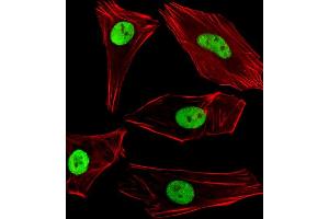 Fluorescent image of SH-SY5Y cells stained with SUMO2/3 Antibody (C-term) (ABIN388034 and ABIN2845512). (SUMO2/3 antibody  (C-Term))