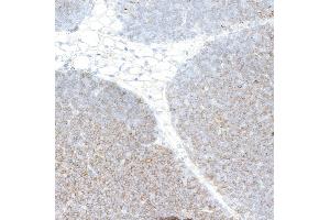 Immunohistochemistry (IHC) image for anti-CD4 (CD4) (AA 407-457) antibody (ABIN7453902) (Recombinant CD4 antibody  (AA 407-457))