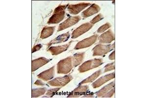 Formalin-fixed and paraffin-embedded human skeletal muscle reacted with ACTR3 Antibody (C-term), which was peroxidase-conjugated to the secondary antibody, followed by DAB staining. (ACTR3 antibody  (C-Term))