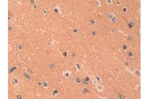 Detection of PKLR in Human Cerebrum Tissue using Polyclonal Antibody to Pyruvate kinase isozymes R/L (PKLR) (PKLR antibody  (AA 219-420))