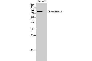 Western Blotting (WB) image for anti-Cadherin 11 (CDH11) (Internal Region) antibody (ABIN3180772) (OB Cadherin antibody  (Internal Region))