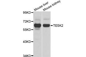 Western blot analysis of extracts of mouse liver and mouse kidney cell lines, using TESK2 antibody. (TESK2 antibody)