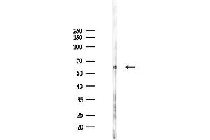 anti-Sorting Nexin 1 (SNX1) (Internal Region) antibody