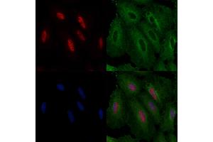 ABIN6261595 and ABIN6276640 staining  cells by IF/ICC. (ERG antibody  (C-Term))
