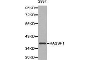 Western Blotting (WB) image for anti-Ras Association (RalGDS/AF-6) Domain Family Member 1 (RASSF1) antibody (ABIN1874555) (RASSF1 antibody)