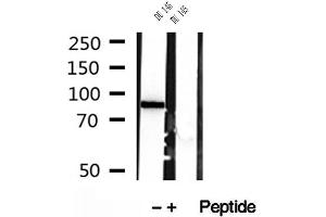 Western blot analysis of extracts of DU 145 cells, using PLOD2-Specific antibody.