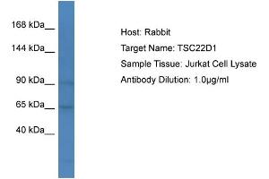 Host: Rabbit Target Name: TSC22D1 Sample Type: Jurkat Whole cell lysates Antibody Dilution: 1. (TSC22D1 antibody  (C-Term))