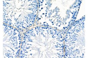 ABIN6258213 and ABIN6273888 at 1/100 staining Rat testis tissue by IHC-P.