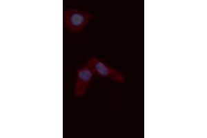 ABIN6276779 staining A549 cells by ICC/IF. (s100a4 antibody  (C-Term))