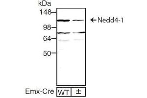 dilution: 1 : 1000, sample: mouse brain homogenate of WT and Nedd4-1f/f;Emx1-Cre± mouse (ECL staining) (NEDD4 antibody)