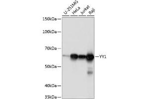 Western blot analysis of extracts of various cell lines, using YY1 antibody (ABIN7271428) at 1:1000 dilution. (YY1 antibody)