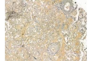 ABIN6258449 and ABIN6275233 at 1/100 staining human normal lung tissue by IHC-P.